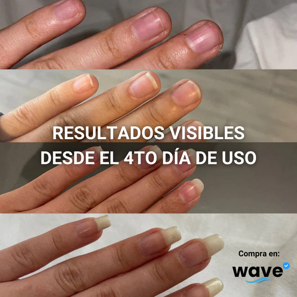 💅(COMPRA 1 & LLEVA 2)🎁 Serum Endurecedor 7 DÍAS - Uñas LARGAS y FUERTES + Envío Gratis